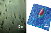 Лазерная интерференционная микроскопия при нозематозе