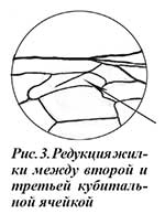 Редукция жилки