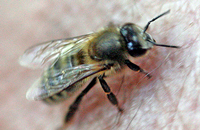 Лечение пчелиным ядом 