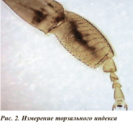 Измерение торзального индекса