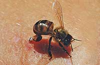 Лечение кокцигодиний пчелоужалением (окончание)