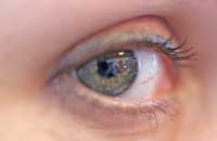 Апитерапия в лечении глазных болезней